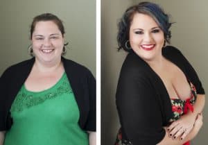 Zwei Bilder einer Frau vor und nach einer Operation zur Gewichtsreduktion.